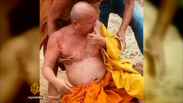 A monk covered in blood due to injuries sustained from a tiger attack at Tiger Temple.